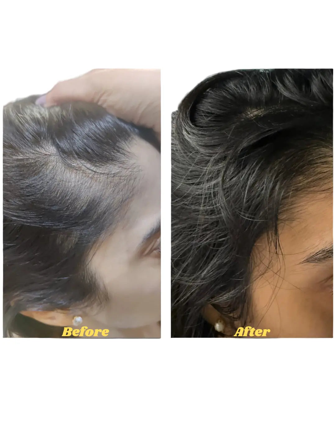 Before and after, twelve weeks of use
